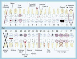 Free Blank Dental Hygiene Chart Notes Template