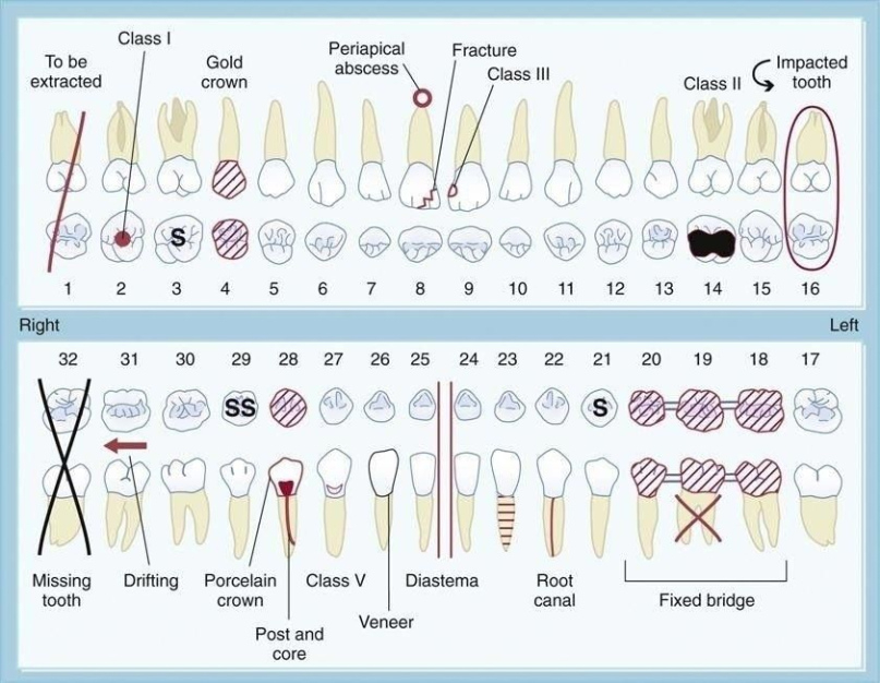 Free Blank Dental Hygiene Chart Notes Template