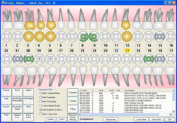 Free Printable Dental Hygiene Chart Notes Template Pdf Sample