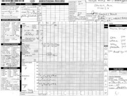 Free Editable Anesthesia Chart Anesthesia Record Template Excel